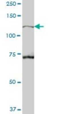 Western Blot: TBC1D2 Antibody [H00055357-B01P]