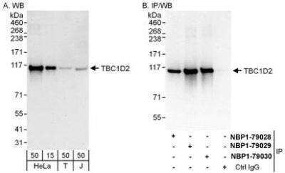 Western Blot: TBC1D2 Antibody [NBP1-79028]