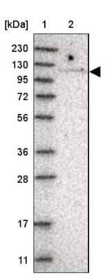 Western Blot: TBC1D2 Antibody [NBP1-87335]