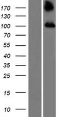 Western Blot: TBC1D2 Overexpression Lysate [NBP2-06798]