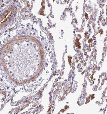 Immunohistochemistry-Paraffin: TBC1D20 Antibody [NBP1-92478]