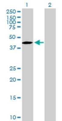 Western Blot: TBC1D20 Antibody [H00128637-B01P]