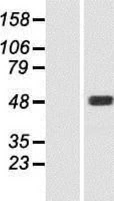 Western Blot: TBC1D20 Overexpression Lysate [NBP2-05556]