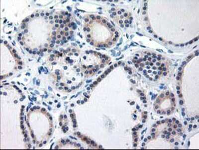 Immunohistochemistry-Paraffin: TBC1D21 Antibody (OTI2A6) [NBP2-01311]