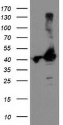 Western Blot: TBC1D21 Antibody (OTI2A6) [NBP2-01311]