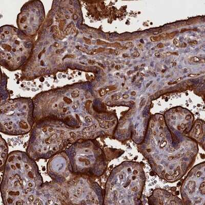 Immunohistochemistry-Paraffin: TBC1D21 Antibody [NBP1-92479]