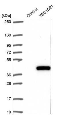 Western Blot: TBC1D21 Antibody [NBP1-92479]