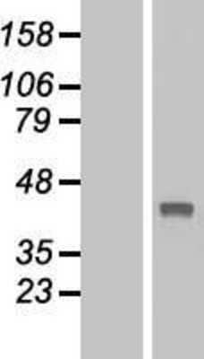 Western Blot: TBC1D21 Overexpression Lysate [NBL1-16727]