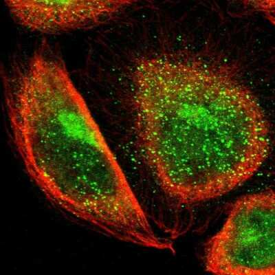 Immunocytochemistry/ Immunofluorescence: TBC1D22A Antibody [NBP1-86811]