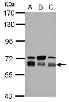 Western Blot: TBC1D22A Antibody [NBP2-20578]