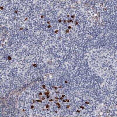 Immunohistochemistry: TBC1D22B Antibody [NBP1-86751]