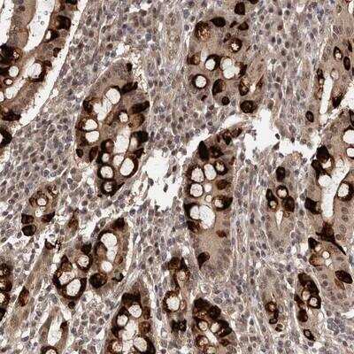 Immunohistochemistry: TBC1D22B Antibody [NBP1-86752]