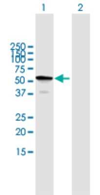 Western Blot: TBC1D22B Antibody [H00055633-B01P]