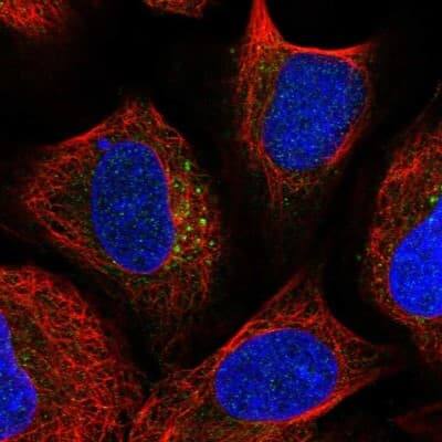 Immunocytochemistry/ Immunofluorescence: TBC1D23 Antibody [NBP1-90420]