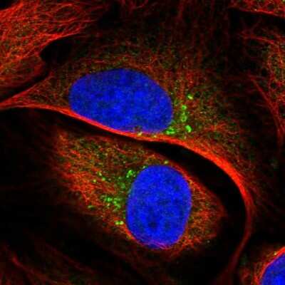 Immunocytochemistry/ Immunofluorescence: TBC1D23 Antibody [NBP1-90421]