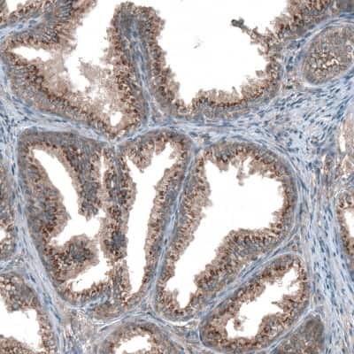 Immunohistochemistry-Paraffin: TBC1D23 Antibody [NBP1-90420]