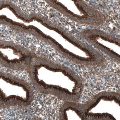 Immunohistochemistry-Paraffin: TBC1D23 Antibody [NBP1-90420]