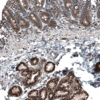 Immunohistochemistry-Paraffin: TBC1D23 Antibody [NBP1-90420]
