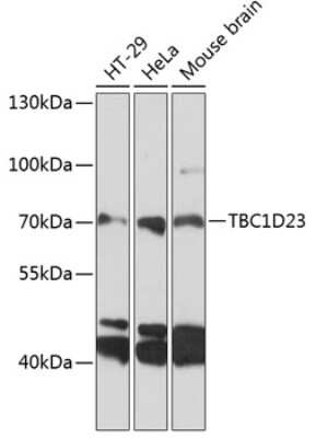 Western Blot: TBC1D23 AntibodyAzide and BSA Free [NBP2-93114]