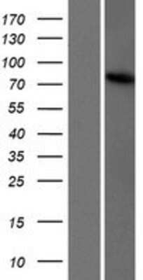 Western Blot: TBC1D23 Overexpression Lysate [NBP2-06826]