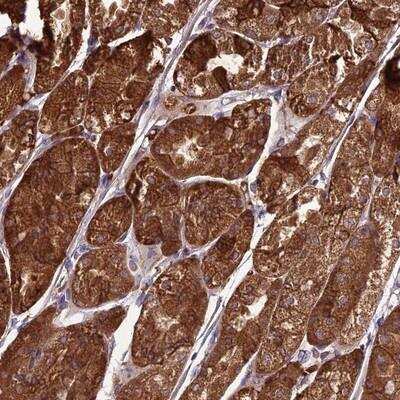 Immunohistochemistry-Paraffin: TBC1D24 Antibody [NBP1-82925]