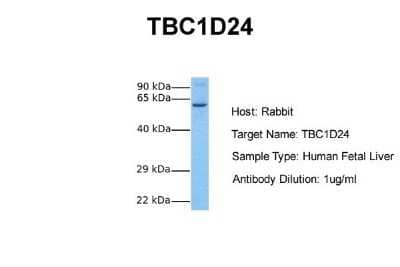 Western Blot: TBC1D24 Antibody [NBP1-55504]