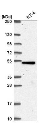 Western Blot: TBC1D24 Antibody [NBP2-57341]