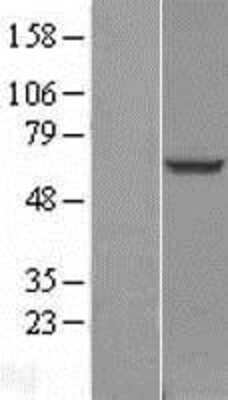 Western Blot: TBC1D24 Overexpression Lysate [NBL1-16729]