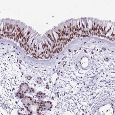 Immunohistochemistry-Paraffin: TBC1D26 Antibody [NBP2-48964]