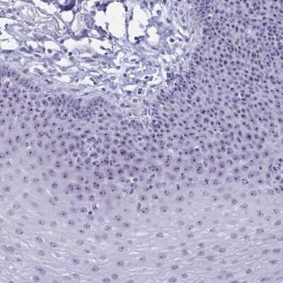 Immunohistochemistry: TBC1D29 Antibody [NBP2-32437]