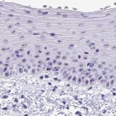 Immunohistochemistry: TBC1D29 Antibody [NBP2-32437]