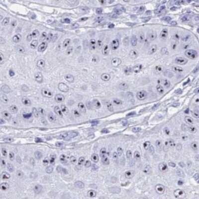 Immunohistochemistry: TBC1D29 Antibody [NBP2-32437]