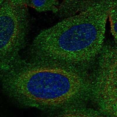 Immunocytochemistry/ Immunofluorescence: TBC1D2B Antibody [NBP2-68643]