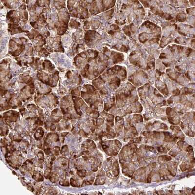 Immunohistochemistry: TBC1D2B Antibody [NBP2-30533]