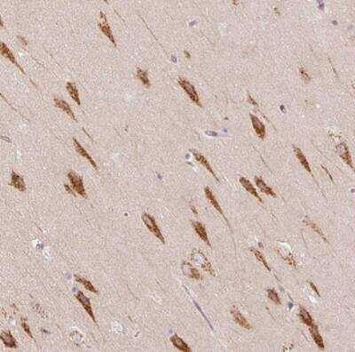 Immunohistochemistry: TBC1D2B Antibody [NBP2-30936]
