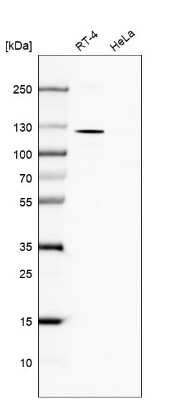 Western Blot: TBC1D2B Antibody [NBP2-30533]