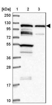 Western Blot: TBC1D2B Antibody [NBP2-30936]