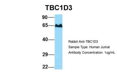 Western Blot: TBC1D3 Antibody [NBP2-86844]