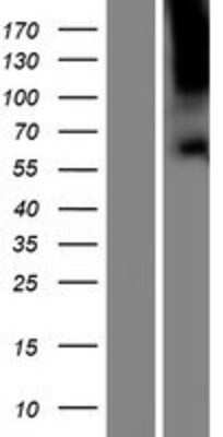 Western Blot: TBC1D3F Overexpression Lysate [NBP2-06059]