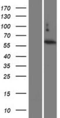 Western Blot: TBC1D3 Overexpression Lysate [NBP2-09416]