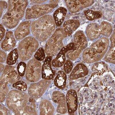 Immunohistochemistry-Paraffin: TBC1D30 Antibody [NBP1-93611]