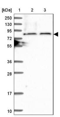 Western Blot: TBC1D30 Antibody [NBP1-93610]