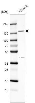 Western Blot: TBC1D32 Antibody [NBP1-90777]