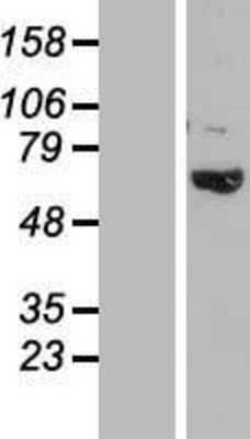 Western Blot: TBC1D3B Overexpression Lysate [NBL1-16732]