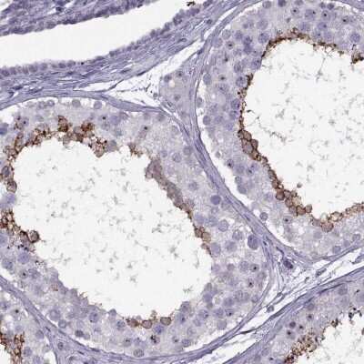 Immunohistochemistry-Paraffin: TBC1D3C Antibody [NBP2-46751]