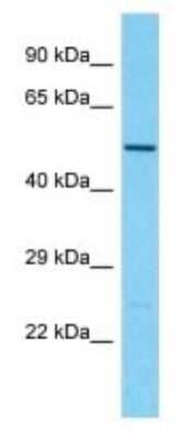 Western Blot: TBC1D3G Antibody [NBP3-09893]