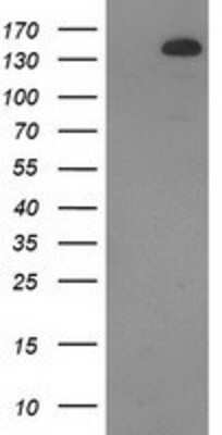 Western Blot: TBC1D4 Antibody (OTI5E6) [NBP2-00597]