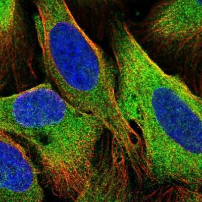 Immunocytochemistry/ Immunofluorescence: TBC1D4 Antibody [NBP2-38460]