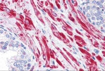 Immunohistochemistry: TBC1D4 Antibody - BSA Free [NBP2-81935]