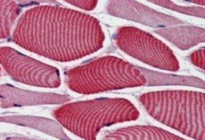 Immunohistochemistry-Paraffin: TBC1D4 Antibody [NB100-57094]